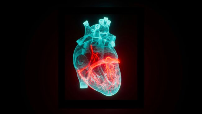 ERA4Health-InterHeart